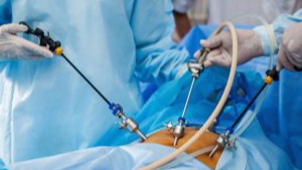 Best Laparoscopic Surgeon in Dhaka.